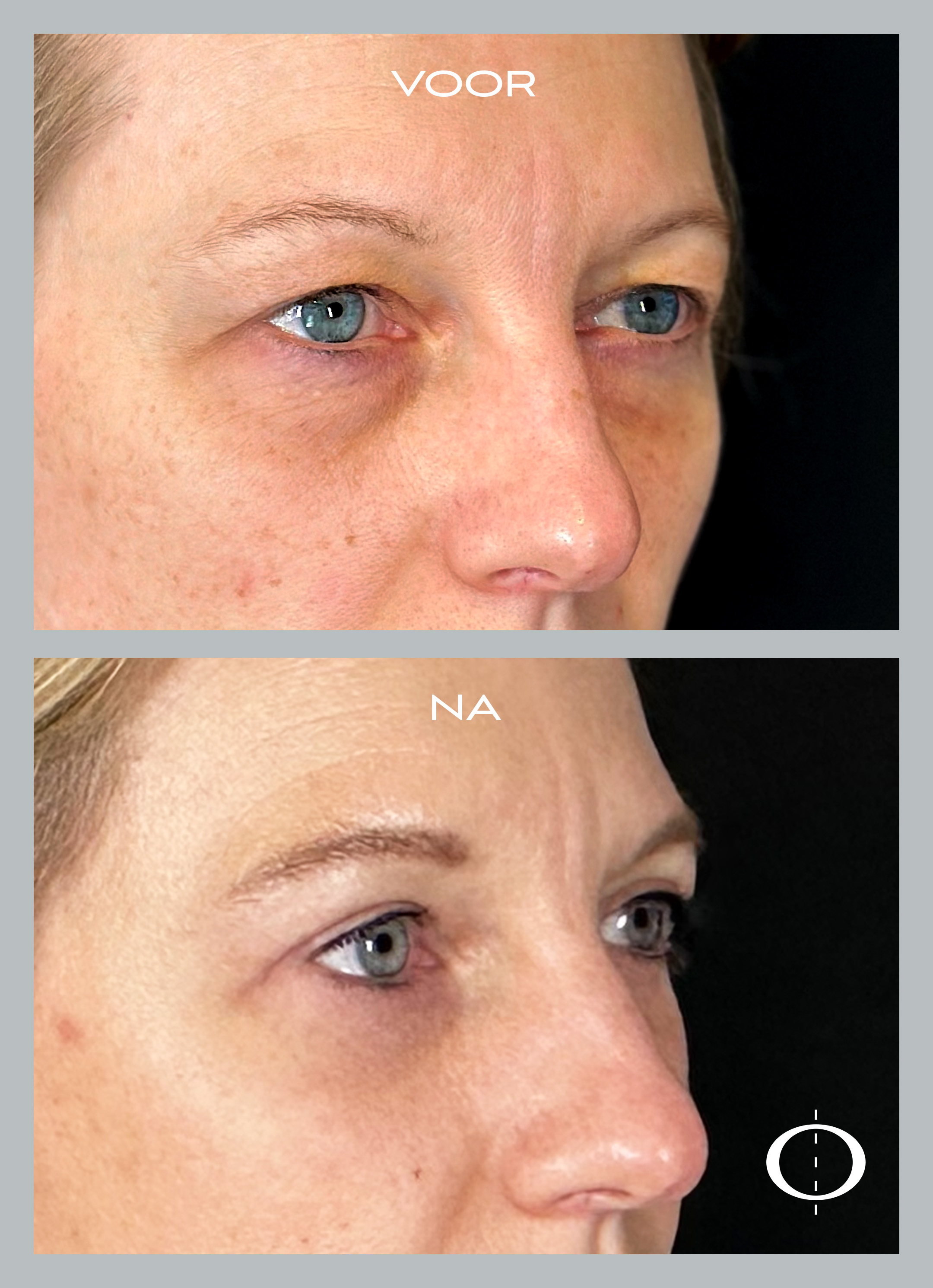 469_Kwart_rechts_web