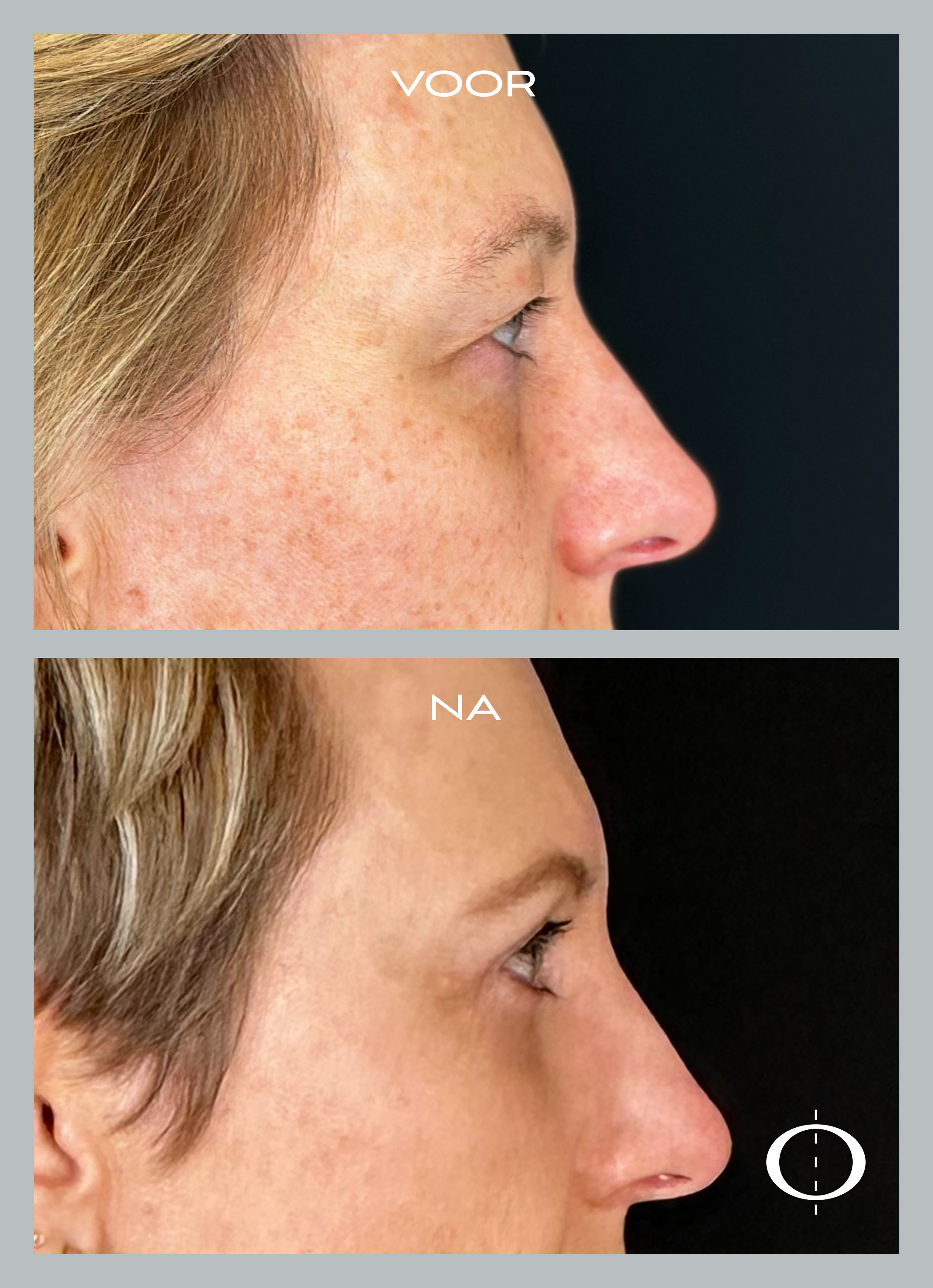 468_Flank_rechts_web